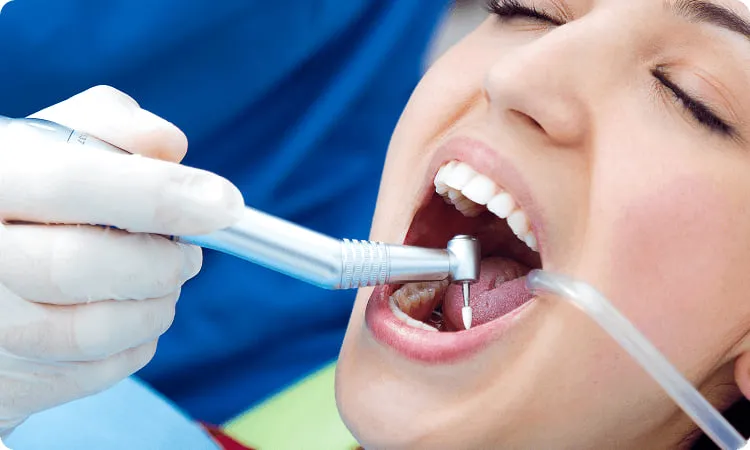 Professional teeth whitening treatment