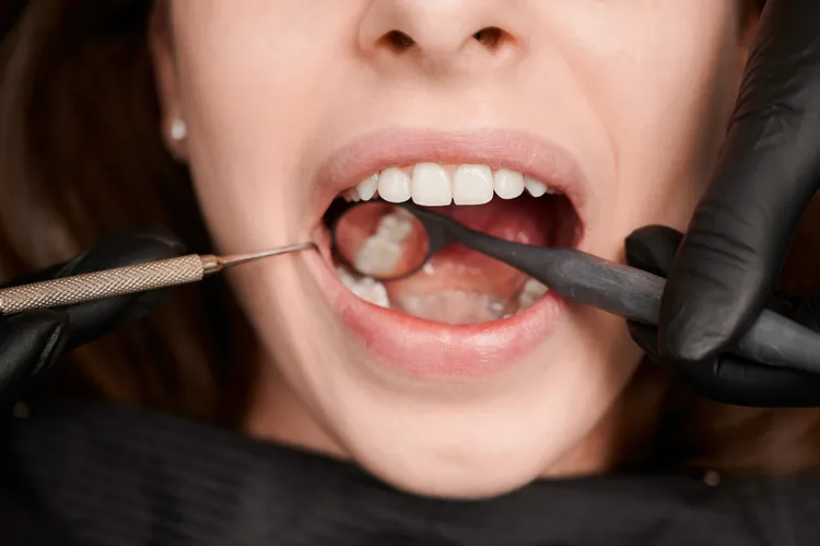 Dental implant procedure