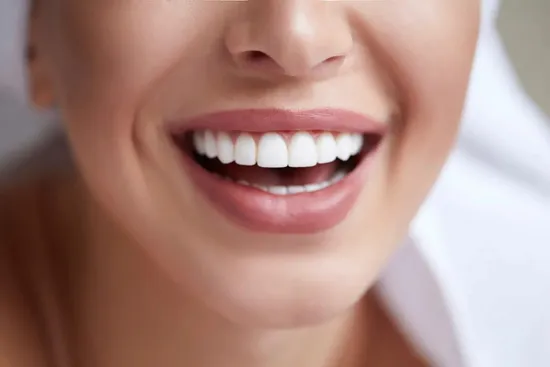 Dental bonding treatment