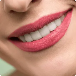 Teeth whitening results